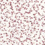 Sally Hansen Esmalte Miracle Gel 909 all Is Bright #4