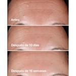 Clinique Smart Routine Set Presentación Tratamiento 2 U #5