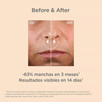 Serúm Antimanchas Isdin Isdinceutics Melaclear Advanced 30 ml #6